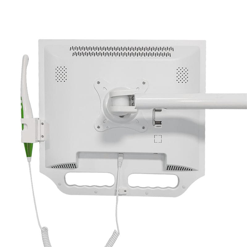 Dental Intra-oral Camera