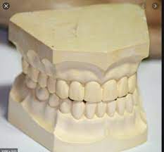 Dental Stone (3kg)